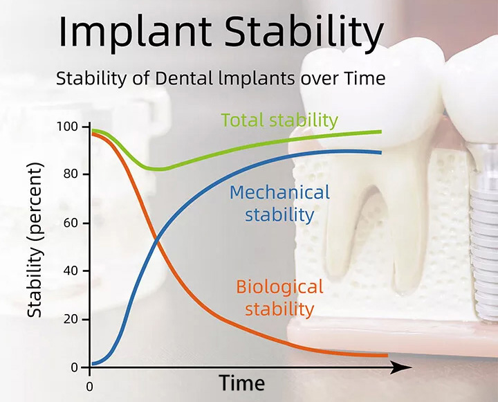 YAHOPE iCHECK Implant Stability Meter Dental Implant Osseointegration Monitor 